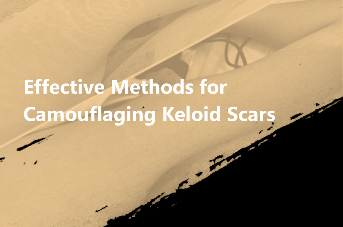 Methods for Camouflaging Keloid Scars – NUE Professional