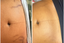 camouflage tattoo on dark skin for scar color blending 