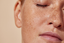 how to cover hyperpigmentation with tattoo