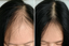 nue strand treatment