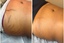 skin repair treatment near me