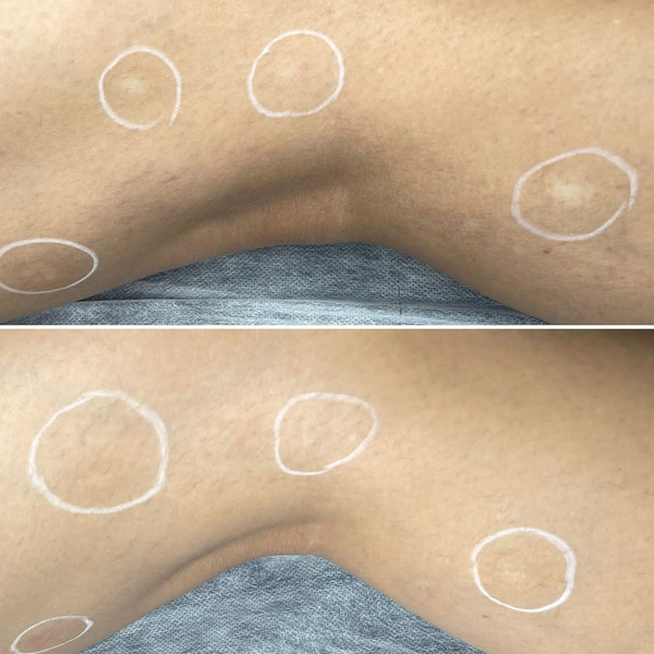Regen Serum