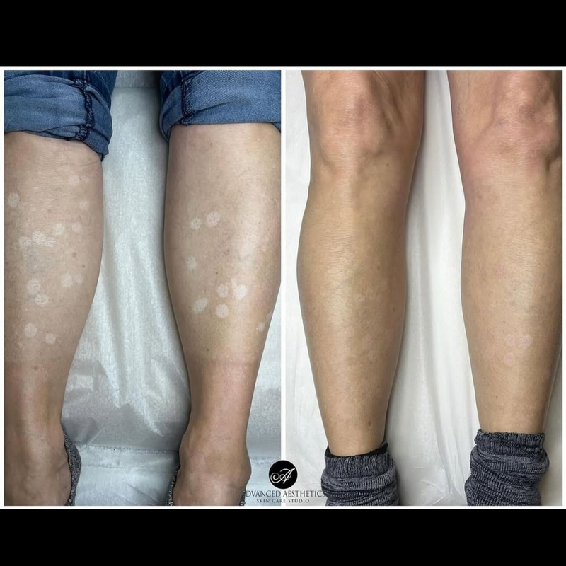 advancedaestheticsskincare