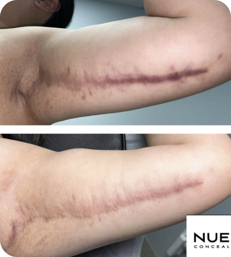 glowgirlrestaurative