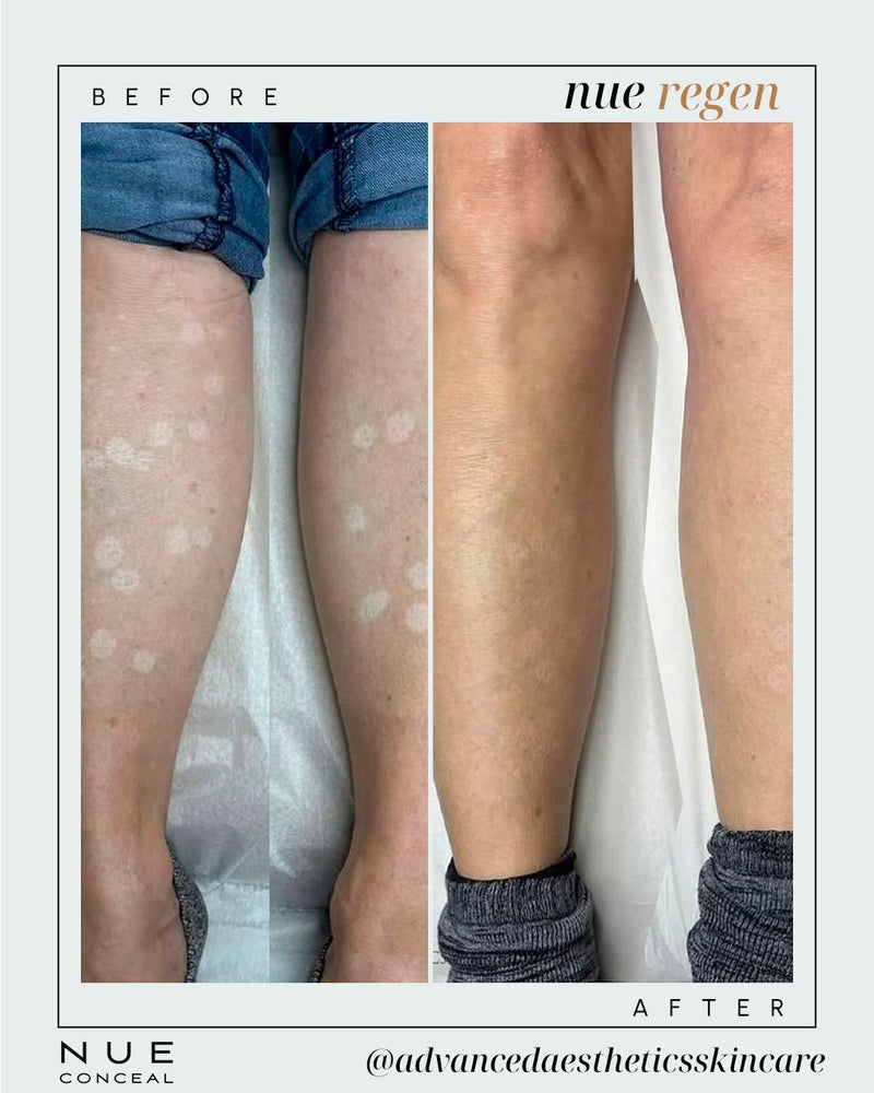 advancedaestheticsskincare