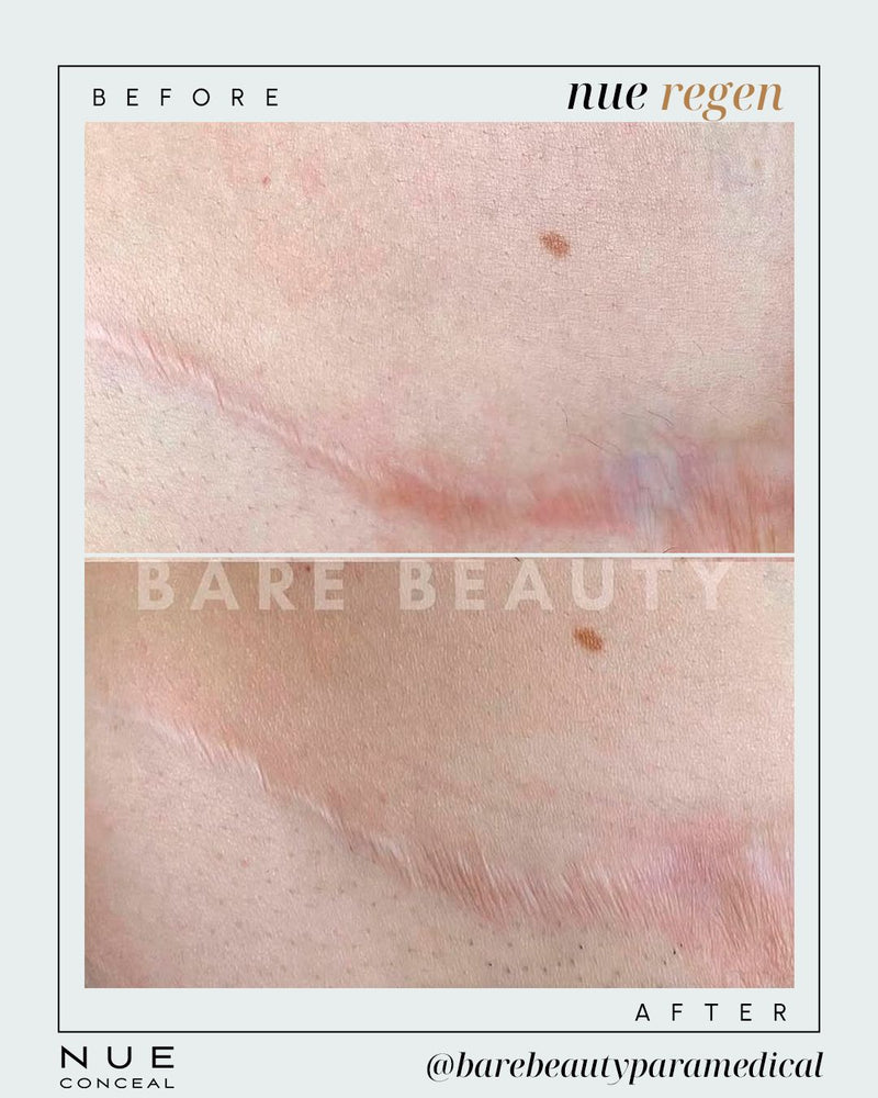 barebeautyparamedical