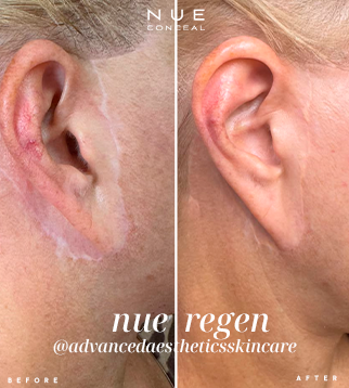 advancedaestheticsskincare