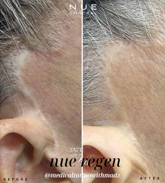 medicaltattoowithmadz